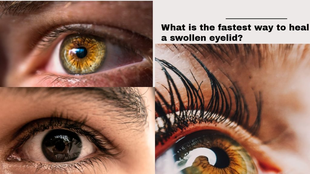 What is the fastest way to heal a swollen eyelid?